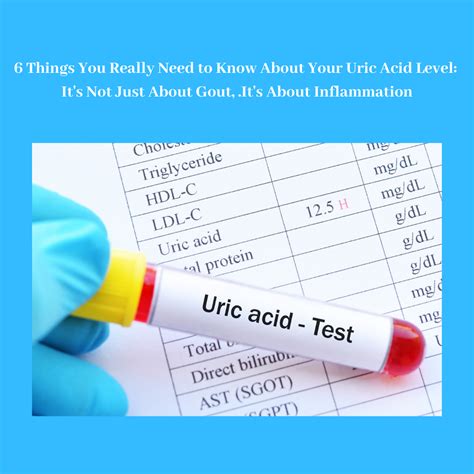 Checking Uric Acid Levels