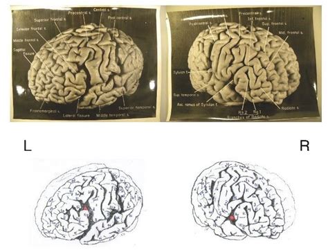 Albert Einstein's Brain: 12 Facts About Gray Matter Of Scientific ...