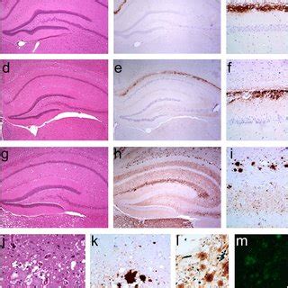 Histological And Immunohistochemical Analysis Of Bv I Infected With