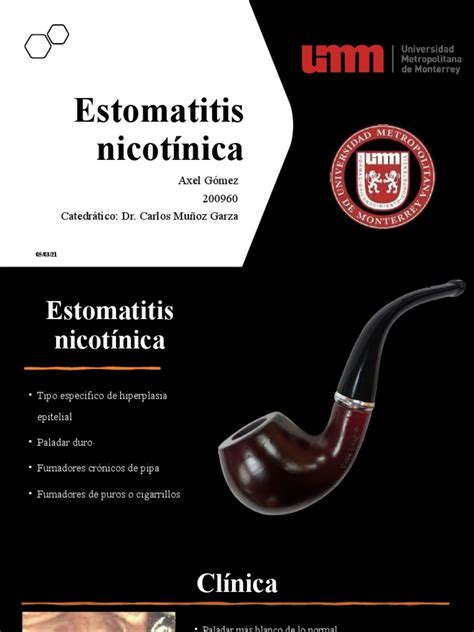 Estomatitis Nicotínica Pdf