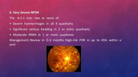 Diabetic Retinopathy