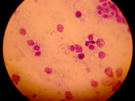 Leishmaniasis Leishmania Impression Smear Michael Wunderli Flickr