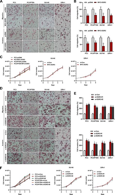 Transwell Migration And Invasion Assays Of Prostate Cancer Download Scientific Diagram