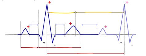 Ecg Ekg Wave Diagram Quizlet