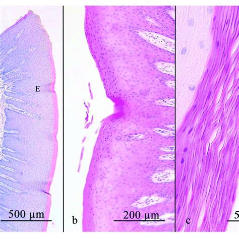 The Gingival Sulcus Was Measured From The Gingival Margin To The