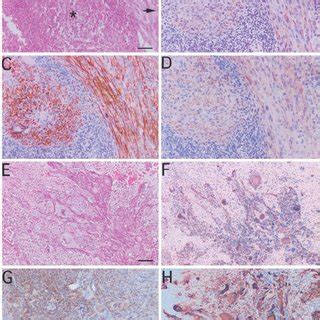 Histological And Immunohistochemical Analysis Of Consecutive Sections