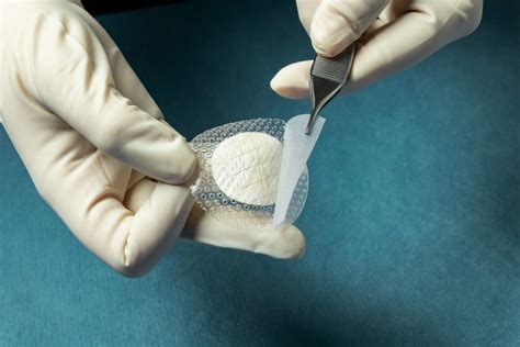 Kerecis Combines Fish Skin Graft And Silicone Cover For Wound Treatment