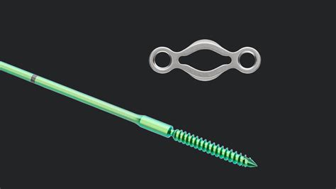 Arthrex Snap Off Compression Ft Pins