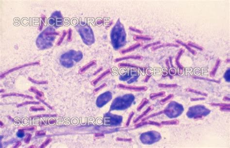 Photograph Bacillus Anthracis Capsules Lm Science Source Images