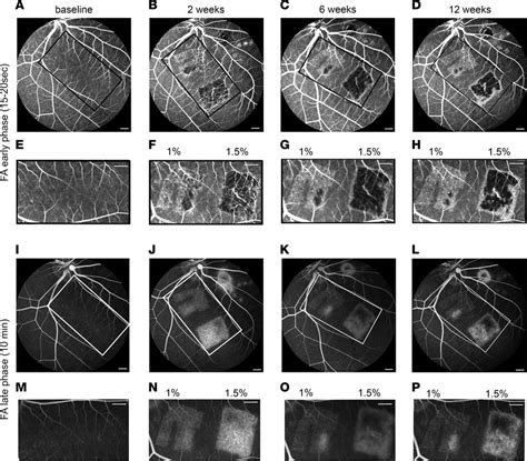 Fluorescein Angiography Fa Of Laser Injured Pig Retina A P Early