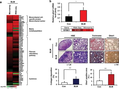 Upregulation Of Gtse1 In Fibrosis Model A A Heat‐map Representing The Download Scientific