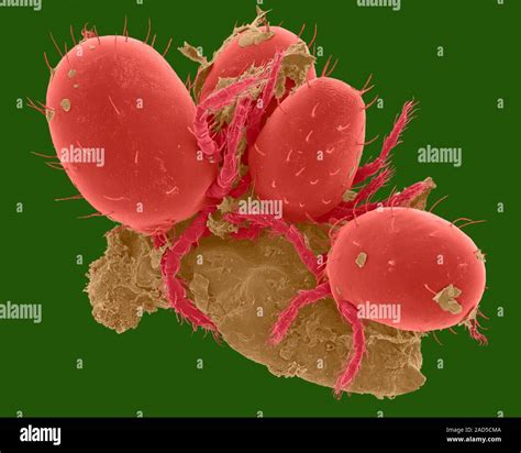 Coloured Scanning Electron Micrograph Sem Of Chiggers Trombicula Sp