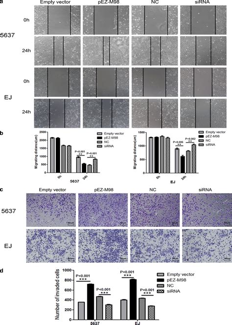 Overexpression Of Tmem Promotes Bladder Cancer Cell Migration And