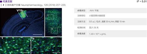 Aav 在神经领域中的应用价格品牌 丁香通官网