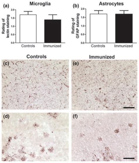 Passive Immunization Targeting Pathological Phospho Tau Protein In A