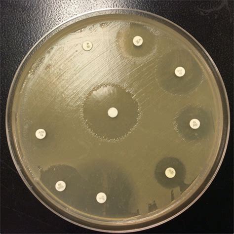 Kirby-Bauer Test (Disk Diffusion Test) – CET Scientific Services Pte Ltd