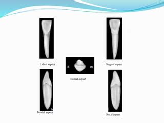 Permanent Mandibular Lateral Incisor | PPT