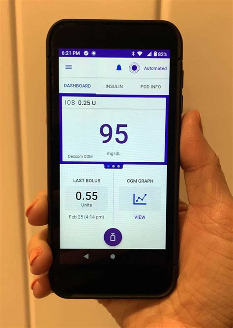 Omnipod 5 Review: Tubeless Automated Insulin Delivery - Diabetes Strong