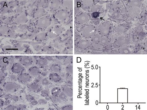 Distribution Of Timp3 Mrna In Drg In Situ Hybridization Shows The