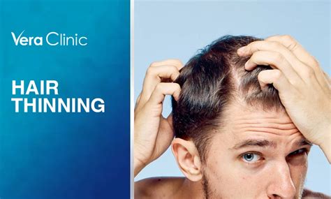 A Comprehensive Guide To Hair Thinning