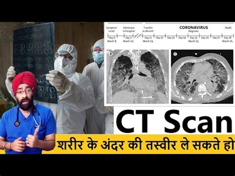 What is CAT Scan CT Scan Test कब और कय Risk Benefit Dr