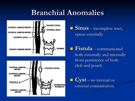 Ppt Pictoral Essay Congenital Anomalies Of The Branchial Apparatus