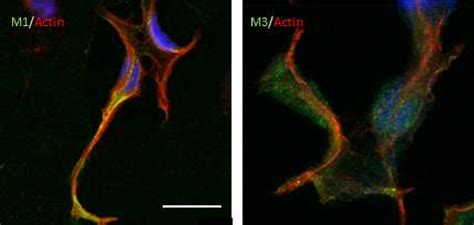 Figure 2 From Physiological Role Of Amyloid Beta In Neural Cells The