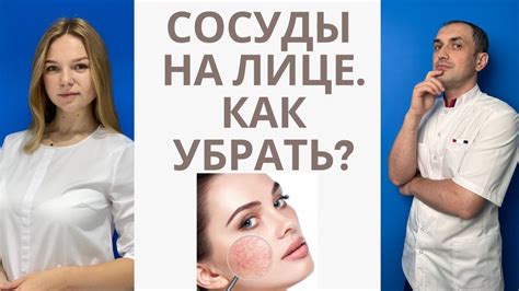 Как убрать сосуды на лице. Флеболог Москва. - YouTube