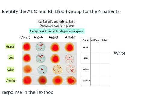 Solved Identify the ABO and Rh Blood Group for the 4 | Chegg.com