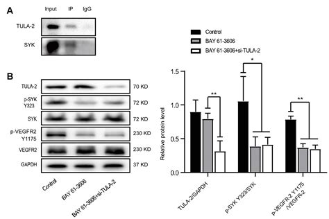 Mir P Promotes Endothelial Cell Angiogenesis In Aging Mice Via Tula