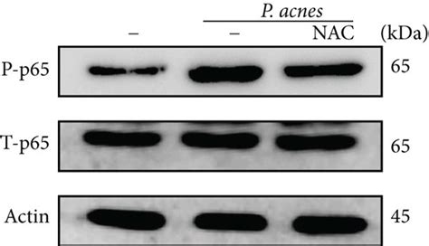 P Acnes Induced Inos No And Cox 2 Pge2 Expressions Via A Ros Dependent