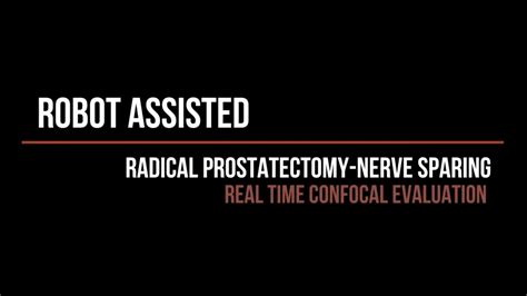 Robot Assisted Radical Prostatectomy Nerve Sparing Youtube