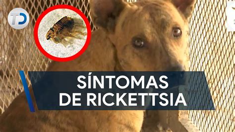 Síntomas de Rickettsia enfermedad por picadura de garrapata YouTube