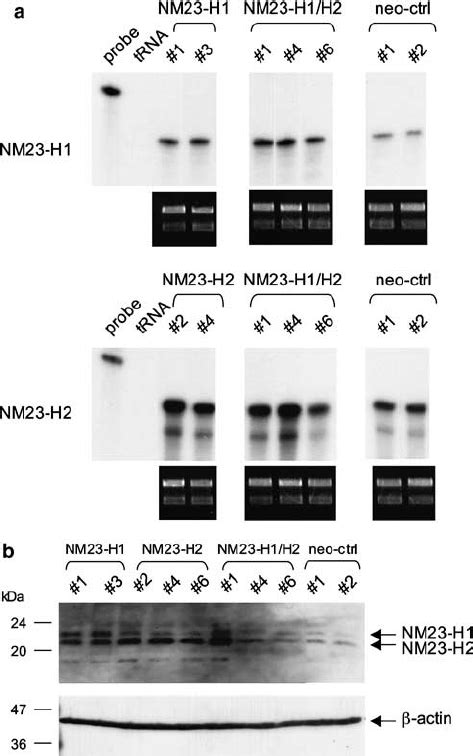 Overexpression Of Nm23 H1 Nm23 H2 Or Nm23 H1 H2 In Hacat