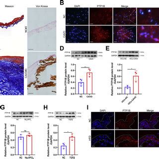 PTP1B Was Highly Expressed In The Calcified Aortic Valves And The