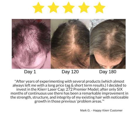 Kiierr Laser Cap Hair Growth System Kiierr Laser Hair Caps Hair