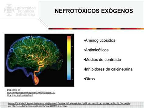 Necrosis Tubular Aguda PPT