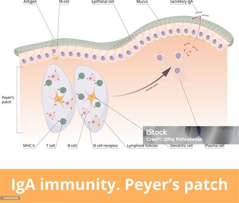 Iga Immunity Peyers Patch Stock Illustration - Download Image Now - Epithelium, Intestine, Small ...