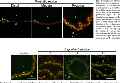 Figure 1 from An improved acridine orange staining of DNA/RNA ...