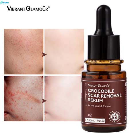 Vibrant Glamour Crocodile Scar Repair Serum Ceramides Face Essence