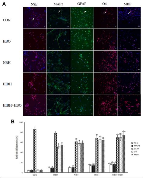 Differentiation Of Nscs Under Different Conditions A The