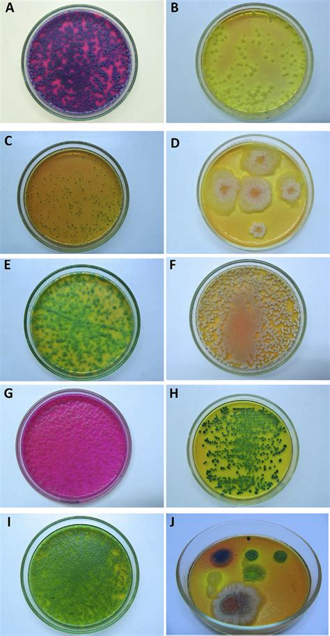 Comparison Of Colony Appearance On Hicrome Bacillus Agar Of Several