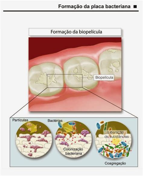 Ortodontia Borel T Rtaro Ou C Lculo Dental