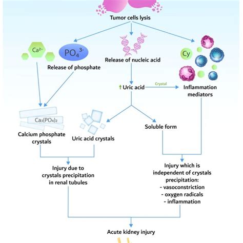 Pathogenesis Of Tumor Lysis Syndrome Resulting In Acute Kidney Injury