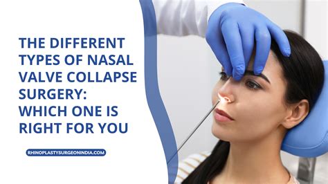 The Different Types Of Nasal Valve Collapse Surgery Which One Is Right