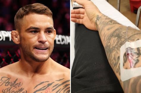 Ufc Star Dustin Poirier In Hospital With Potentially Life Threatening Staph Infection And Warns