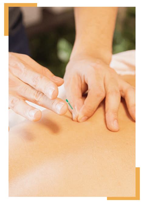 Dry Needling Physical Therapy And Its Benefits Onerehab