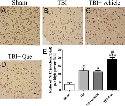 The Representative Photomicrographs Showing Nrf Immunohistochemistry