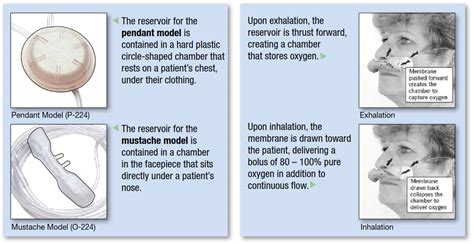 Drive Medical Oxymizer Disposable Oxygen Conservers