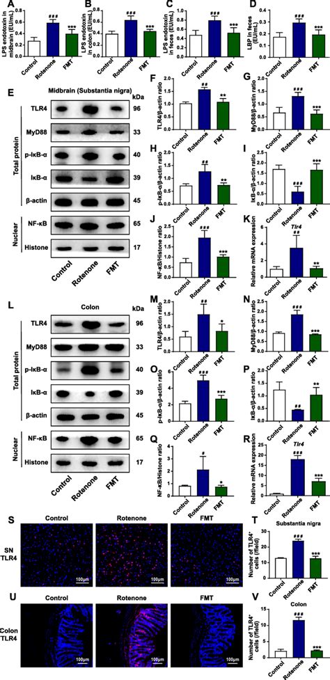 FMT administration inhibits the TLR4 MyD88 NF κB signaling pathway in